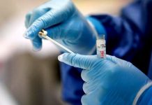 Los PCR se realizan solo a casos sospechosos