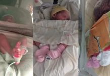 Un caso cada 200 millones: nacieron trigemelas idénticas en Mar del Plata y están bien de salud