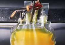 Coronavirus: un estudio reveló que el tratamiento con plasma no es efectivo en pacientes graves