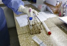 Coronavirus: confirmaron 5.645 casos nuevos y 129 fallecidos en las últimas 24 horas