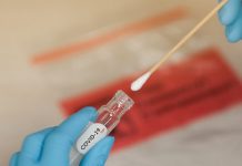 Coronavirus en Argentina: confirmaron 67 muertes y 1.397 contagios en las últimas 24 horas