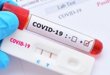 Coronavirus en la Argentina: 12 muertes y 2445 casos en las últimas 24 horas