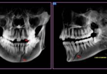 Le fracturo el maxilar a una menor de 17 años y amenazó con matarla si lo dejaba