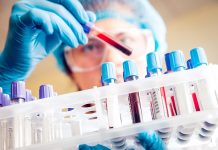 El IPS sancionará a la Asociación Bioquímica por cobros indebidos a afiliados y habilitó el reintegro del dinero