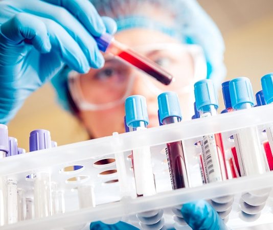 El IPS sancionará a la Asociación Bioquímica por cobros indebidos a afiliados y habilitó el reintegro del dinero
