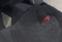 Un delincuente le mordió la mano y le arranco una falange a un policía jujeño