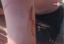 Un joven fue herido con un machete cuando intentaron robarle la moto en Orán