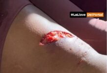 Advierten en Quijano sobre los ataques de perros detrás del Polideportivo Bulila Diez