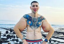 Se inyectó vaselina en los bíceps para hacerlos más grandes y ahora podría perder ambos brazos