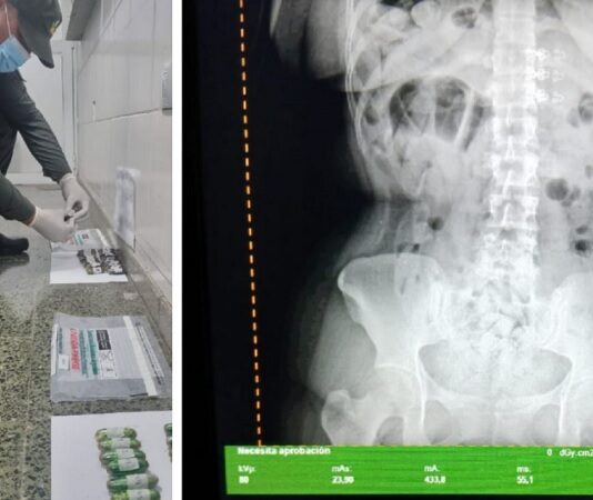 3 bolivianas detenidas en Tucumán al haber tragado 198 capsulas de cocaína