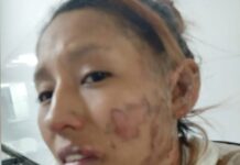 Pidió auxilio tras ser quemada por su pareja, la fiscalía soltó al agresor, hoy la mujer lleva 5 días desaparecida