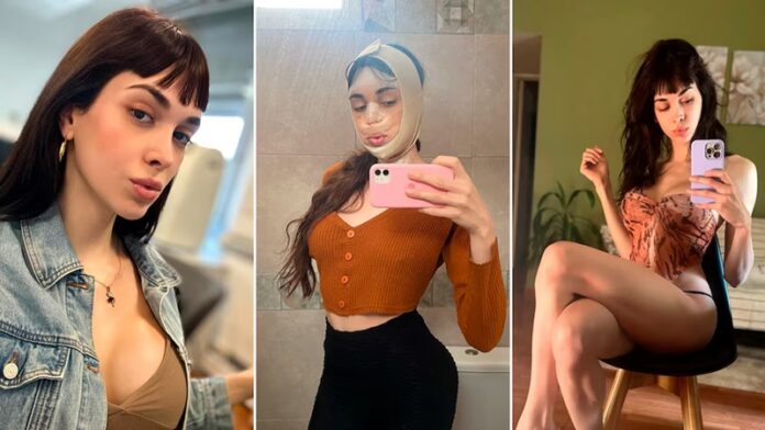 trans operada